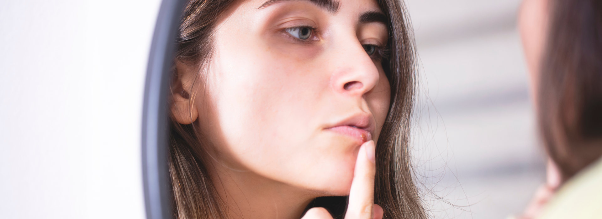 woman points to cold sore