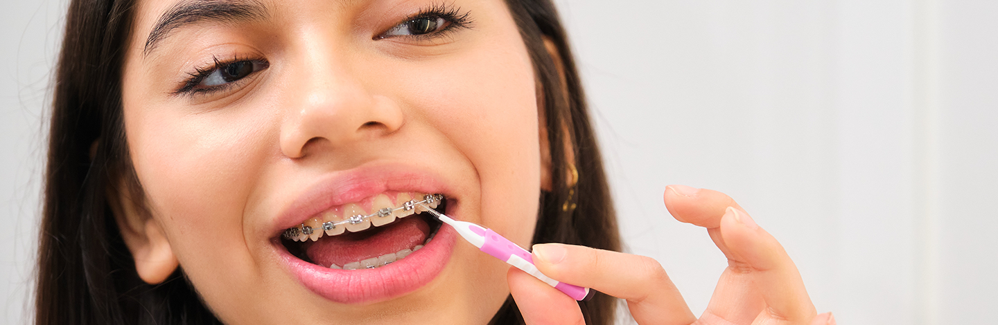 girl cleans braces with small brush