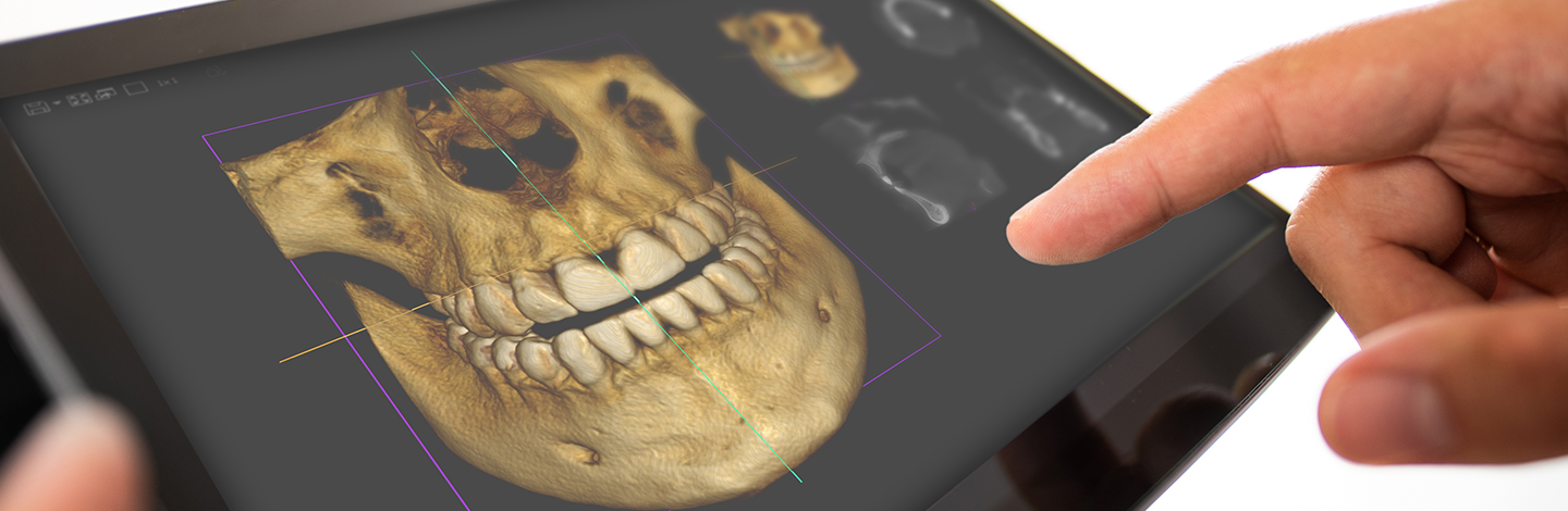 Dental procedure with the help of 3D tooth scanner technology