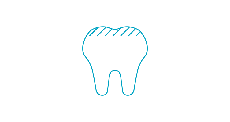 14903-6 Apr-ToothLife-752x400_ToothStain