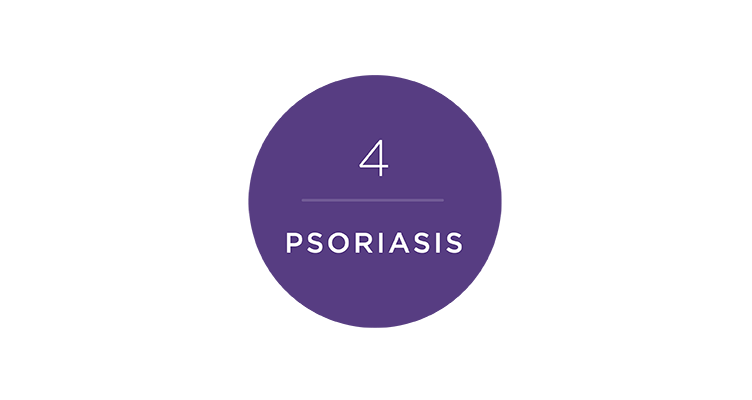 psoriasis-752x400